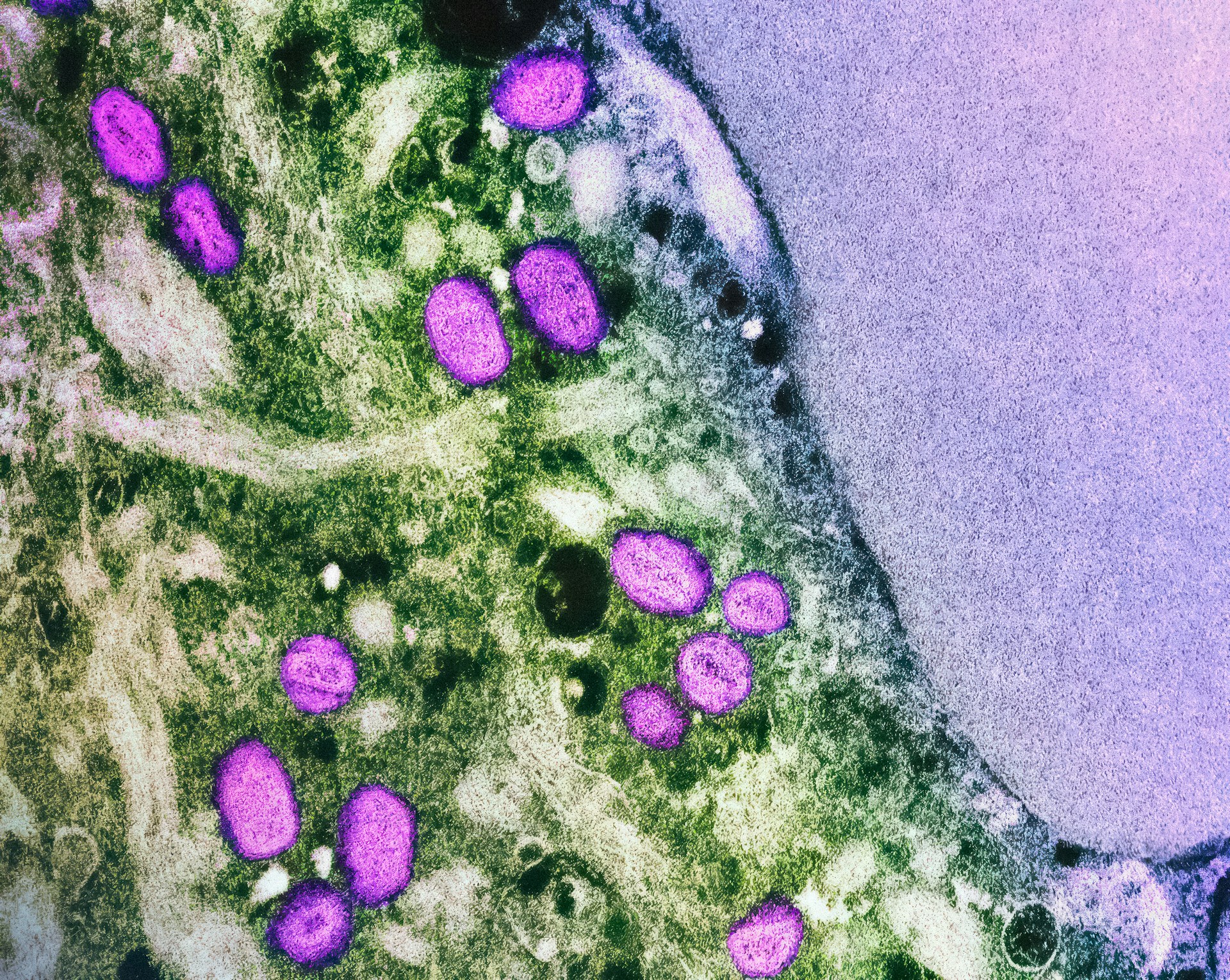 FAO’s role in tackling mpox: A One Health approach to addressing emerging zoonoses