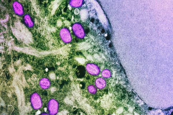 mpox virus