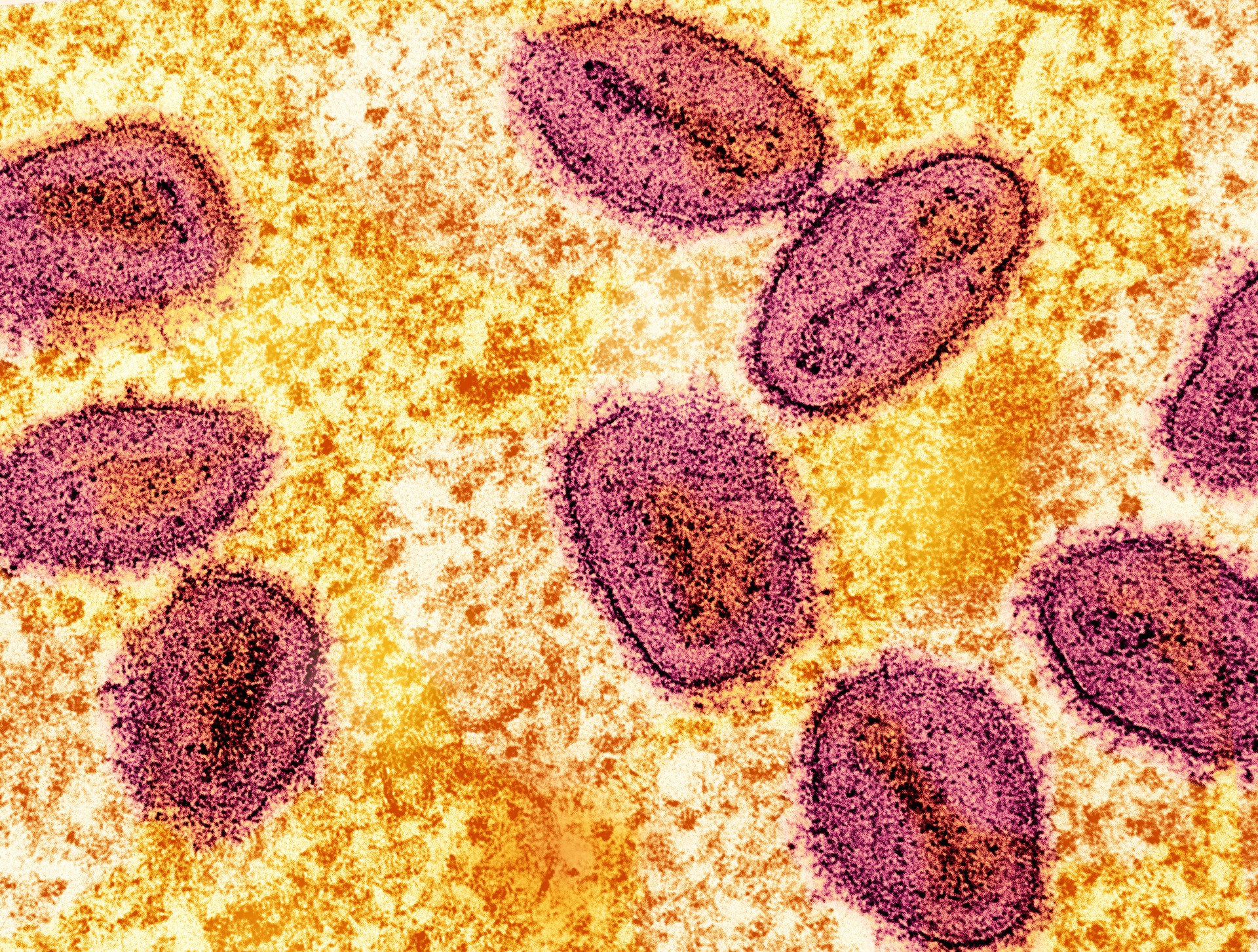 FAO and the mpox outbreak