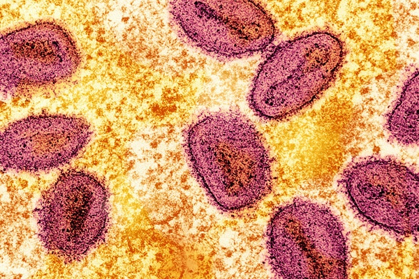 national-institute-of-allergy-and-infectious-diseases